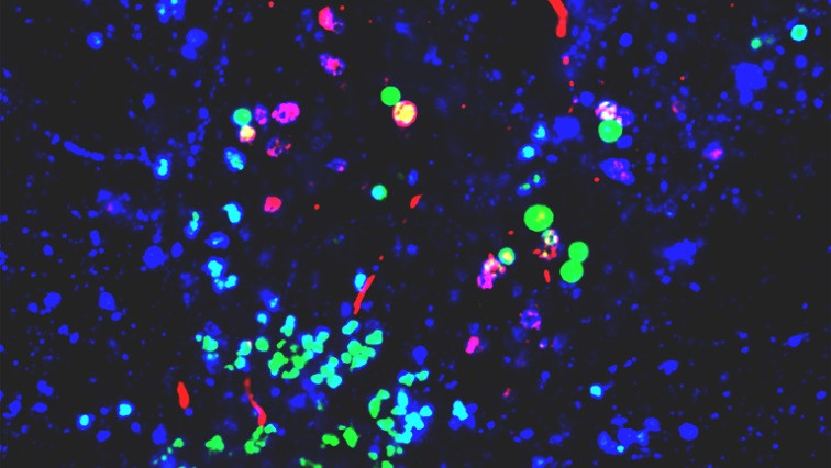 Nanoplastics Promote Conditions for Parkinson’s Across Various Lab Models